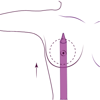 W Clinics Preserve Brustvergroesserung-Lipo-Doctors-Lipödem